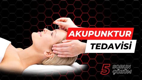Fizyoterapi ve Akupunktur: İkili Uygulamanın Faydaları
